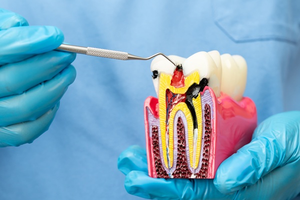 Endodontics Treatment For Tooth Pain